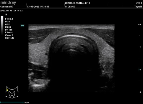 Ультразвуковая система Mindray Consona N7Q фото 37