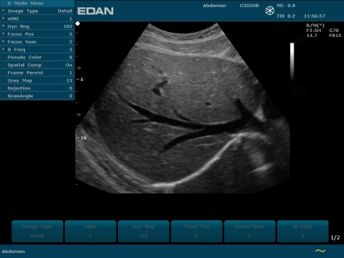 УЗИ аппарат Edan U50 Prime Edition фото 20