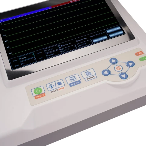 Электрокардиограф Med-Mos ECG600G — компактный 6-канальный аппарат для эффективной диагностики сердца в больницах, клиниках и амбулаториях фото 7