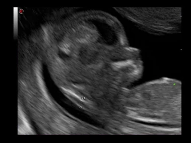 УЗИ аппарат Esaote MyLab Alpha фото 12