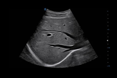 УЗИ аппарат SIUI Apogee 6500 фото 5