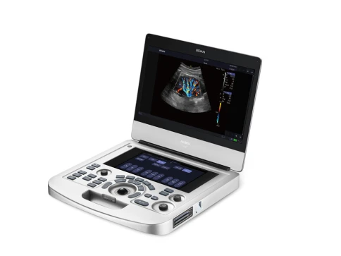 УЗИ аппарат Edan Acclarix AX2 фото 1