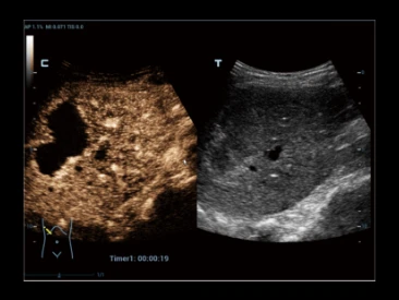 УЗИ аппарат Mindray Resona R9 фото 10