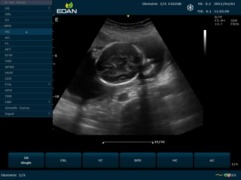 УЗИ аппарат Edan U50 Prime Edition фото 28