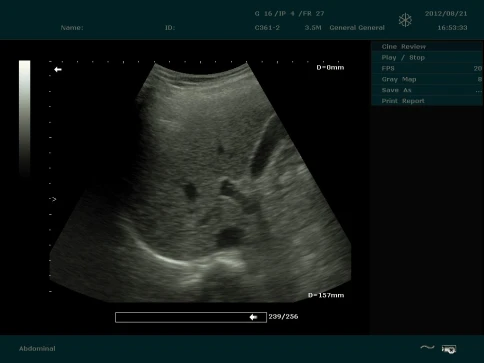 Аппарат УЗИ Edan Dus 60 фото 23