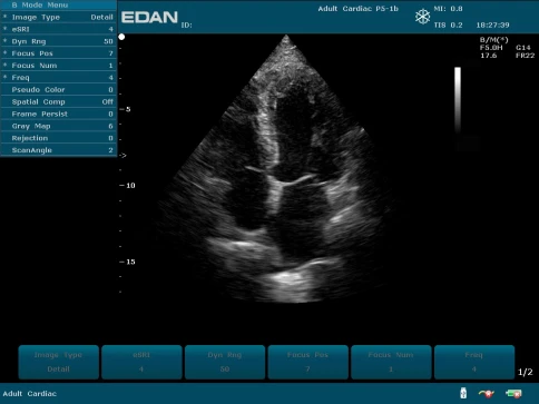 УЗИ аппарат Edan U50 Prime Edition фото 42