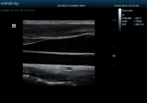 УЗИ аппарат Mindray DP-50 Vet фото 6