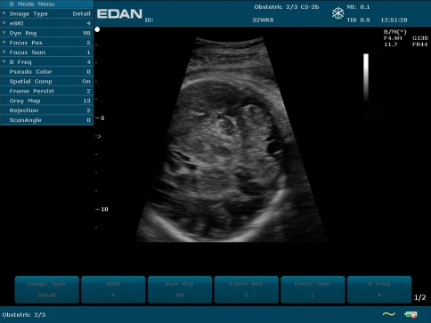 УЗИ аппарат Edan U50 Prime Edition фото 25
