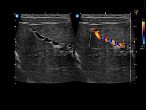 УЗИ аппарат Edan U50 Prime Edition фото 4