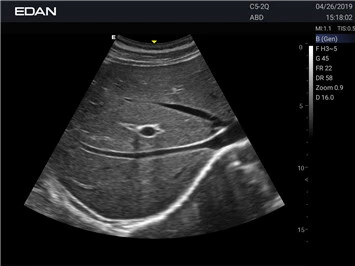 УЗИ аппарат Edan Acclarix AX2 фото 8