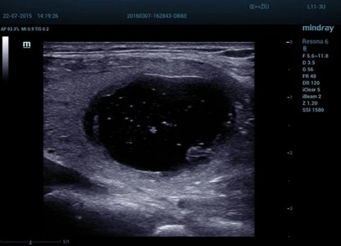 УЗИ аппарат Mindray Resona 6 Exp фото 7