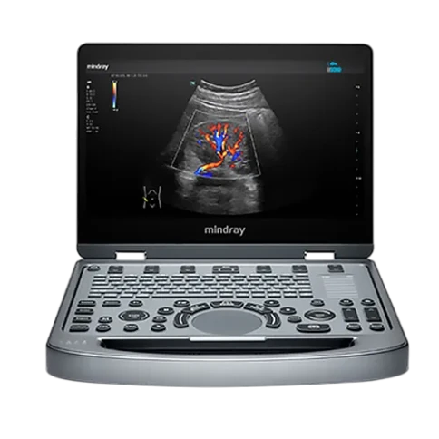 УЗИ аппарат Mindray MX3 фото 2
