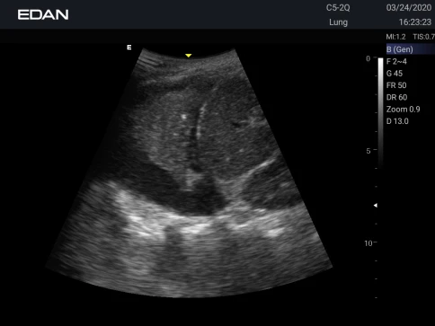 УЗИ аппарат Edan Acclarix AX3 фото 43