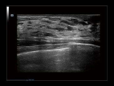 УЗИ аппарат Mindray Resona R9 фото 9