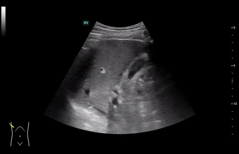 УЗИ аппарат Mindray Consona N8 фото 11