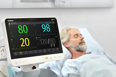 Монитор пациента Mindray ePM15 фото 3