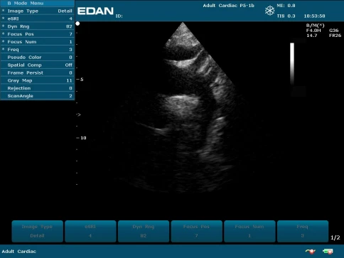 УЗИ аппарат Edan U50 Prime Edition фото 43