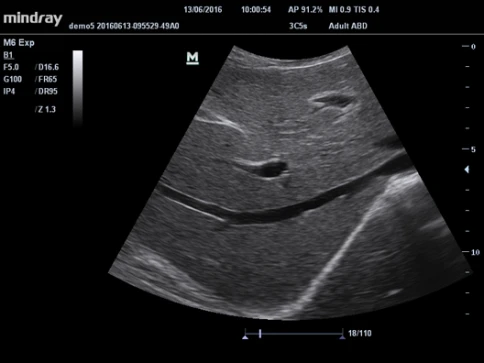 УЗИ аппарат Mindray M6 exp фото 14