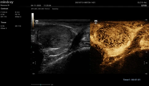 Ультразвуковой аппарат Mindray Resona I9 фото 13