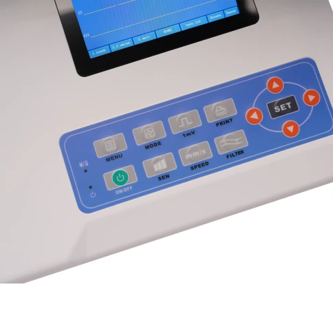 Электрокардиограф Med-Mos ECG300G — компактный 3-канальный прибор для точной диагностики сердца в больницах, поликлиниках и амбулаториях фото 3