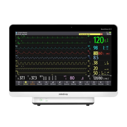 Монитор пациента Mindray BeneVision N17 фото 1